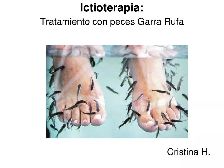 ictioterapia tratamiento con peces garra rufa