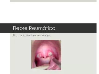 fiebre reum tica