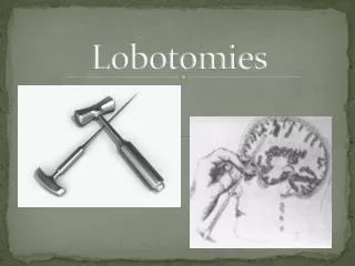 Lobotomies