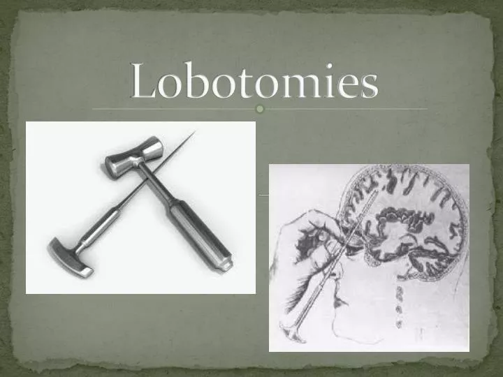 lobotomies