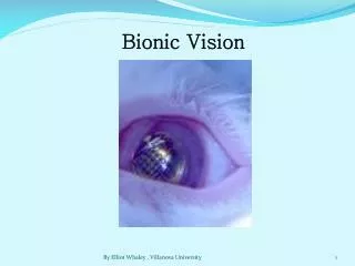 Bionic Vision