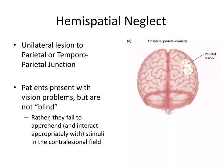 hemispatial neglect