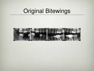 Original Bitewings
