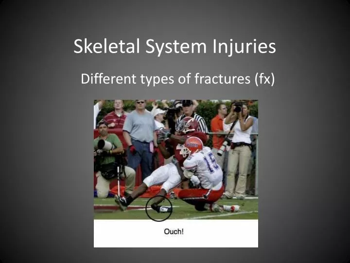 skeletal system injuries