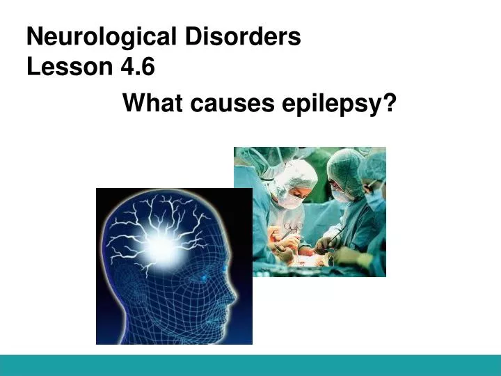 neurological disorders lesson 4 6