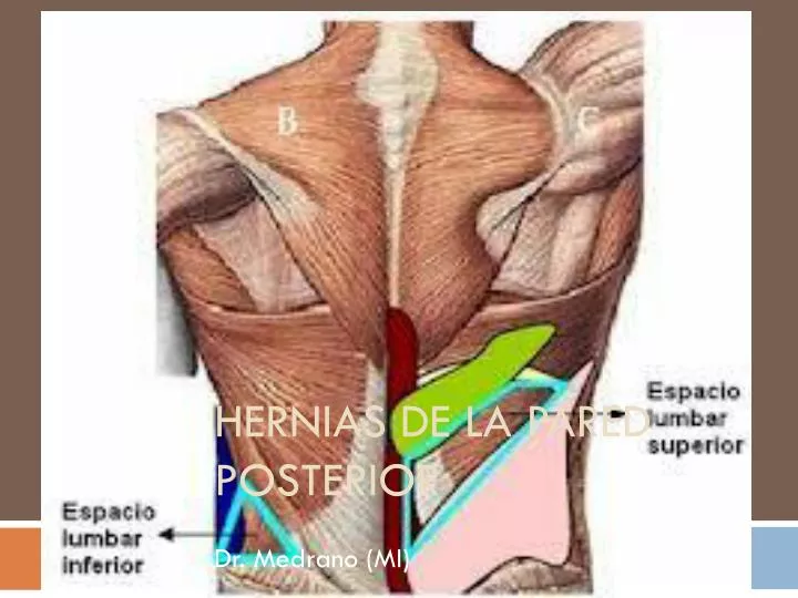 hernias de la pared posterior