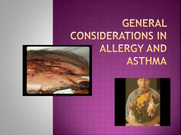 general considerations in allergy and asthma