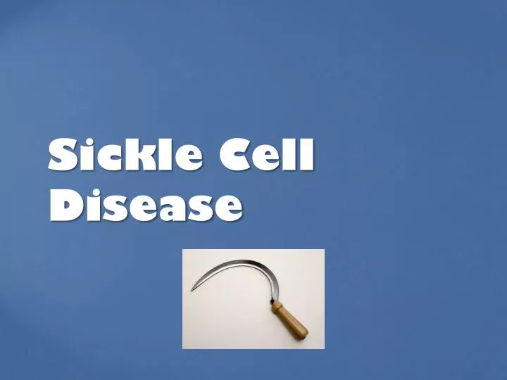 sickle cell disease