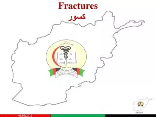 fractures