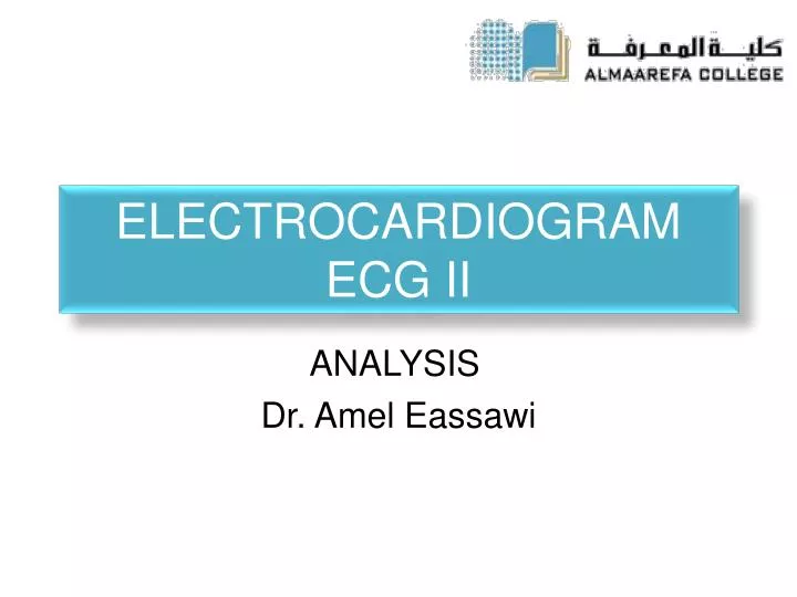 electrocardiogram ecg ii