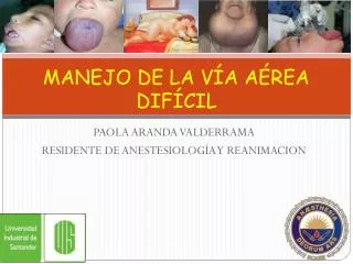 manejo de la v a a rea dif cil