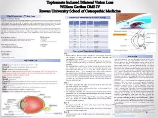 Topiramate Induced Bilateral Vision Loss William Gartlan OMS IV