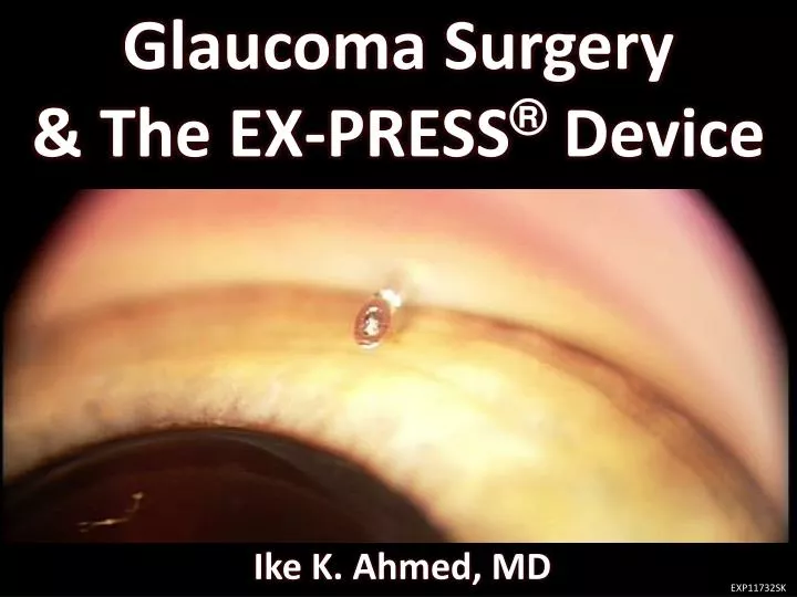 glaucoma surgery the ex press device