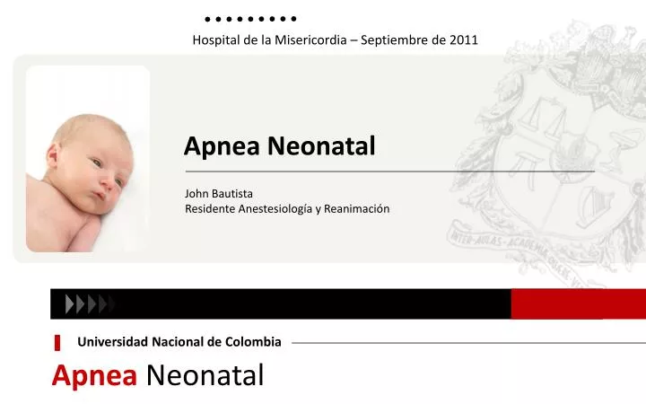 apnea neonatal