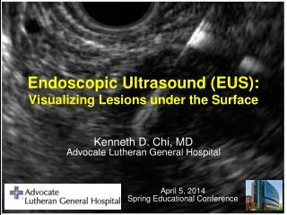 Endoscopic Ultrasound (EUS): Visualizing Lesions under the Surface