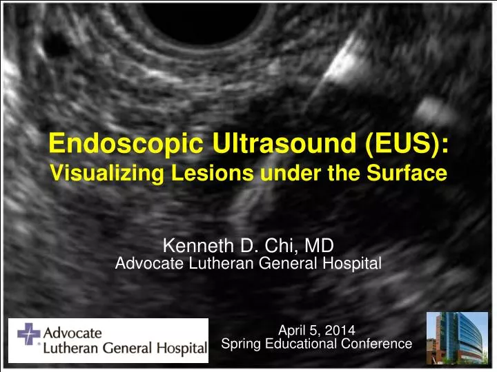 endoscopic ultrasound eus visualizing lesions under the surface