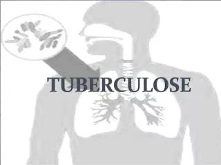 tuberculose
