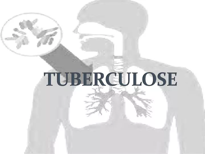 tuberculose