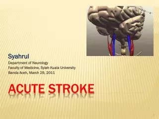 acute stroke