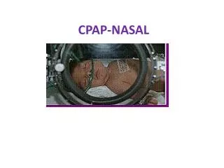 CPAP-NASAL