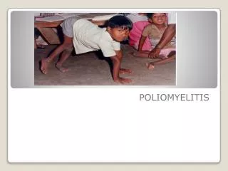 POLIOMYELITIS