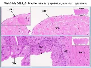 WebSlide 0098_G: Bladder (simple sq. epithelium, transitional epithelium)