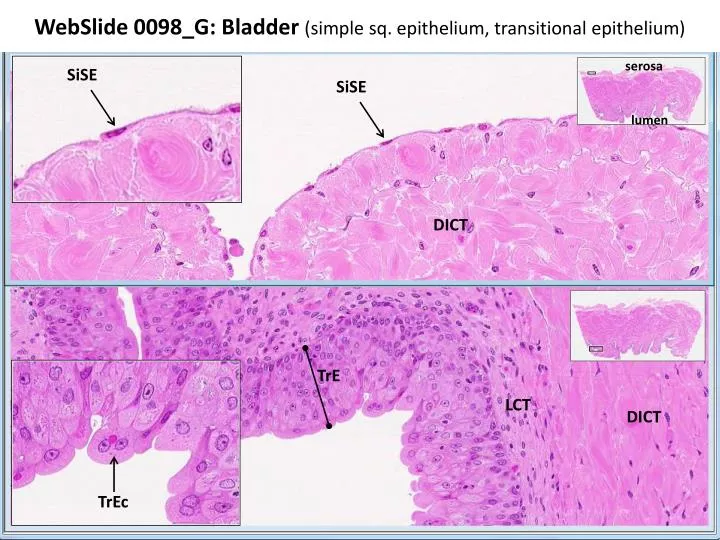 webslide 0098 g bladder simple sq epithelium transitional epithelium