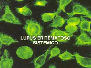 lupus eritematoso sistemico