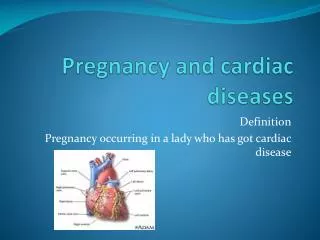 Pregnancy and cardiac diseases