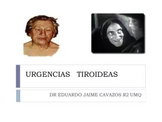 urgencias tiroideas