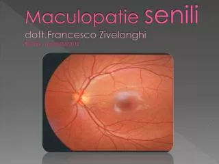 maculopatie senili dott francesco zivelonghi rotary mn 02 04 2012