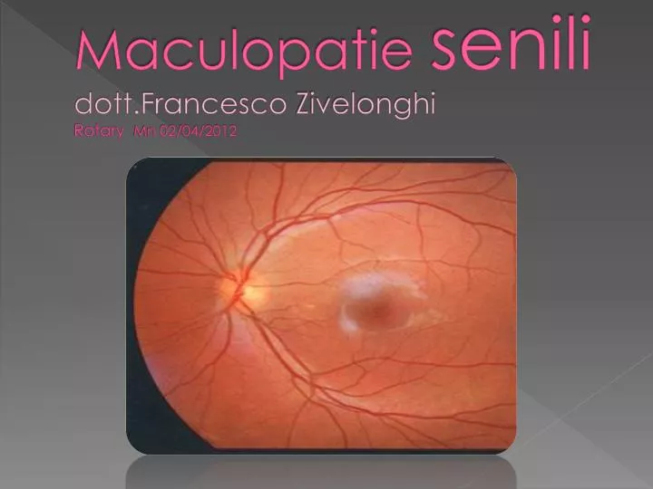 maculopatie senili dott francesco zivelonghi rotary mn 02 04 2012
