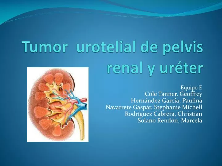 tumor urotelial de pelvis renal y ur ter