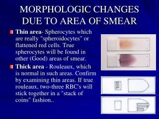 MORPHOLOGIC CHANGES DUE TO AREA OF SMEAR