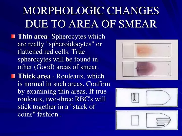 morphologic changes due to area of smear