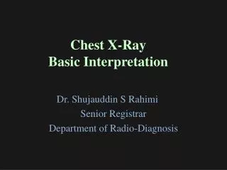 Chest X-Ray Basic Interpretation
