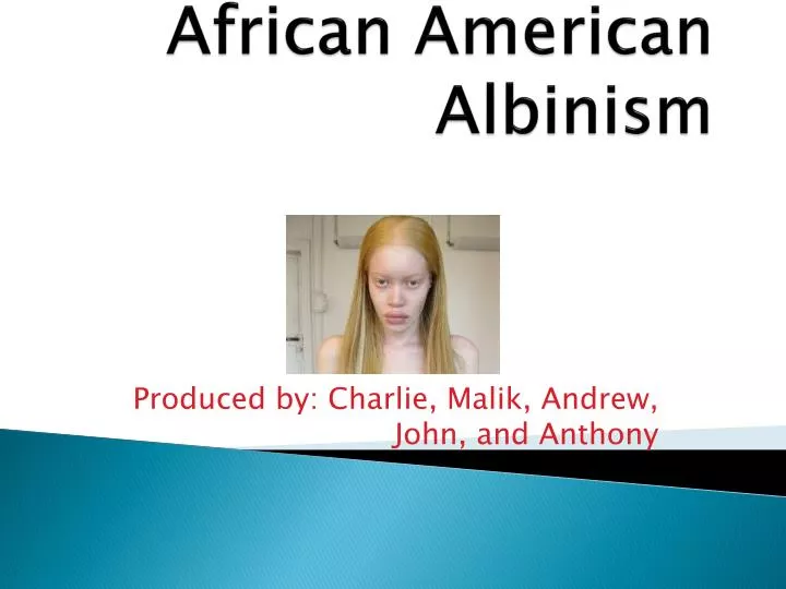 african american albinism