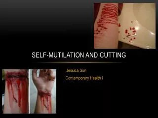 Self-Mutilation and Cutting