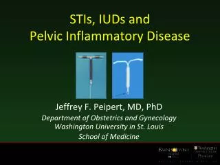 STIs, IUDs and Pelvic Inflammatory Disease