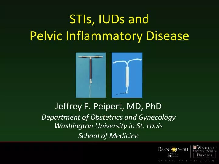 stis iuds and pelvic inflammatory disease