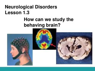 Neurological Disorders Lesson 1.3