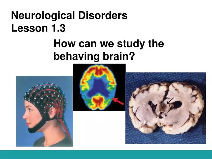 neurological disorders lesson 1 3