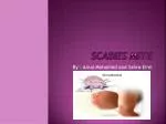 Scabies mite - slide 1