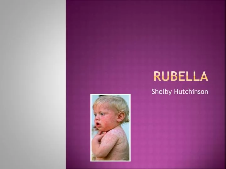 rubella