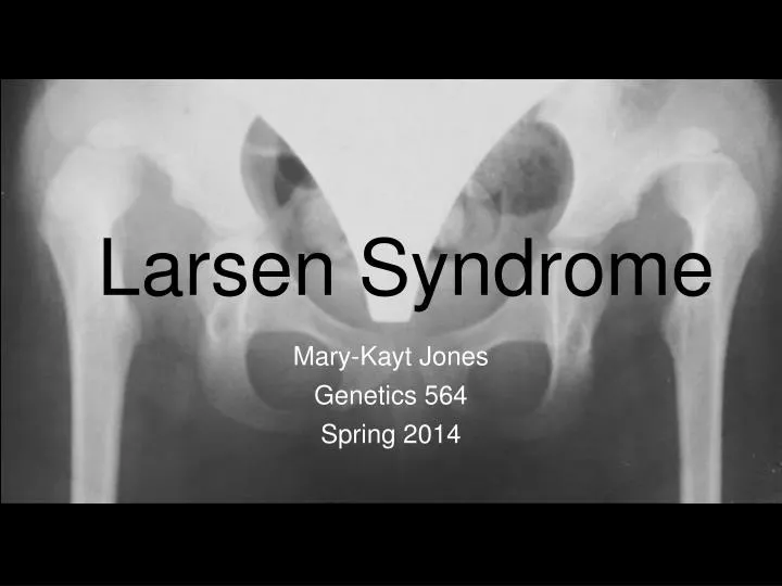 larsen syndrome