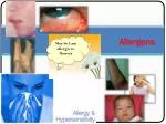 Allergens - slide 1