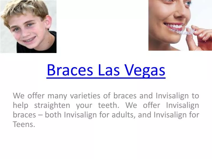 braces las vegas