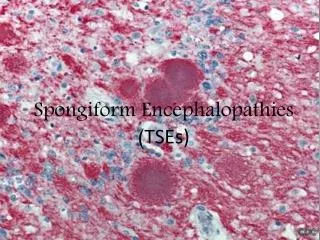 Spongiform Encephalopathies ( TSEs)