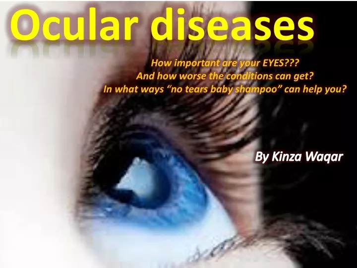 ocular diseases