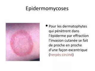 epidermomycoses